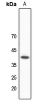 1 - Anti-hNRNP C Antibody AP60015