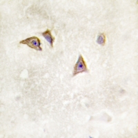 19 - Anti-IFNAR1 (Phospho-Y466) Antibody AP60017