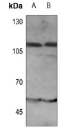 1 - Anti-IFNAR1 (Phospho-Y466) Antibody AP60017