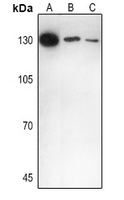1 - Anti-IL-16 Antibody AP60018