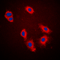 3 - Anti-Cytokeratin 18 (Phospho-S33) Antibody AP60020