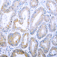 19 - Anti-Cytokeratin 18 (Phospho-S33) Antibody AP60020