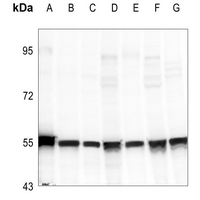 1 - Anti-Cytokeratin 18 (Phospho-S33) Antibody AP60020