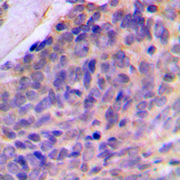 19 - Anti-Galectin 8 Antibody AP60021