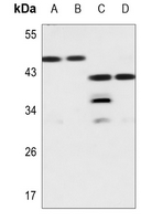 1 - Anti-Galectin 8 Antibody AP60021