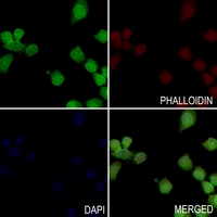 3 - Anti-LIMK1/2 Antibody AP60022