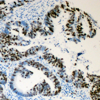 19 - Anti-Lamin A/C (Phospho-S392) Antibody AP60023