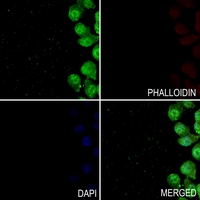 3 - Anti-TAU (Phospho-T498) Antibody AP60025