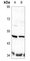 1 - Anti-TAU (Phospho-T498) Antibody AP60025