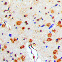 19 - Anti-TAU (Phospho-T529) Antibody AP60026