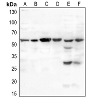 1 - Anti-MDM2 (Phospho-S166) Antibody AP60027