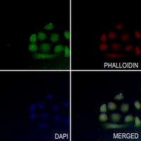 3 - Anti-MEF2A (Phospho-T319) Antibody AP60028