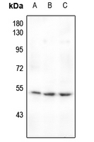 1 - Anti-MEF2A (Phospho-T319) Antibody AP60028