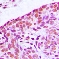 19 - Anti-MEKK3 Antibody AP60029