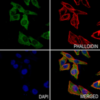 3 - Anti-MMP16 Antibody AP60031