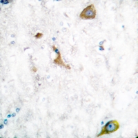 19 - Anti-MMP16 Antibody AP60031