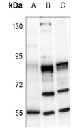 1 - Anti-MMP16 Antibody AP60031
