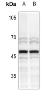 1 - Anti-MNDA Antibody AP60032