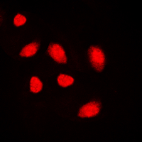 3 - Anti-MUTYH Antibody AP60033