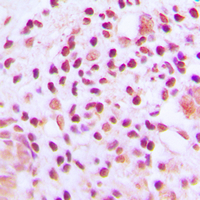 19 - Anti-MUTYH Antibody AP60033