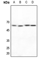 1 - Anti-NAB2 Antibody AP60035