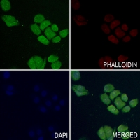 3 - Anti-Merlin (Phospho-S518) Antibody AP60036