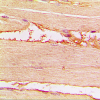 19 - Anti-Merlin (Phospho-S518) Antibody AP60036