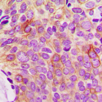 19 - Anti-Osteoprotegerin Antibody AP60037