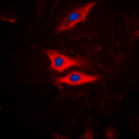 3 - Anti-PLA2G4A (Phospho-S505) Antibody AP60038