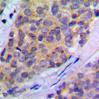 19 - Anti-PLA2G4A (Phospho-S505) Antibody AP60038