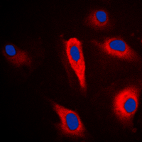3 - Anti-PLA2G4A Antibody AP60039