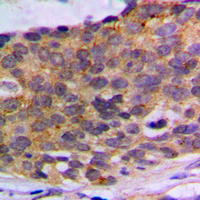 19 - Anti-PLA2G4A Antibody AP60039