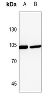 1 - Anti-PLA2G4A Antibody AP60039