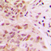 19 - Anti-Rpb1 CTD (Phospho-S1619) Antibody AP60040