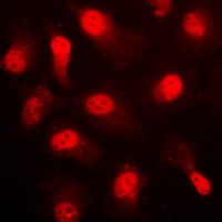 3 - Anti-AMPK alpha 1 (Phospho-S496) Antibody AP60041