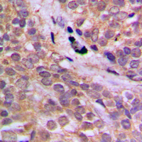 19 - Anti-AMPK alpha 1 (Phospho-S496) Antibody AP60041