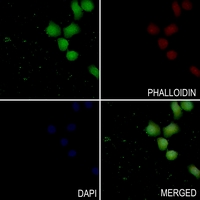3 - Anti-PKC delta (Phospho-Y313) Antibody AP60042