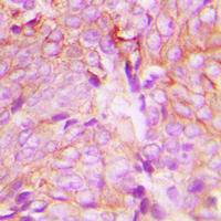 19 - Anti-PKC delta (Phospho-Y313) Antibody AP60042