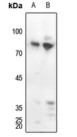 1 - Anti-PKC delta (Phospho-Y313) Antibody AP60042