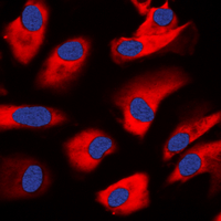 3 - Anti-PKC zeta Antibody AP60043