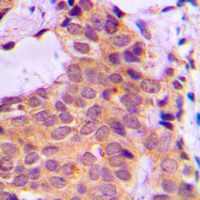 19 - Anti-PKC zeta Antibody AP60043