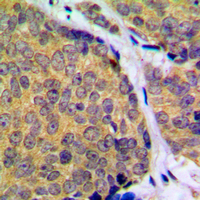 19 - Anti-MKK2 (Phospho-T394) Antibody AP60045