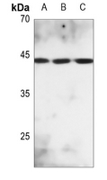 1 - Anti-MKK2 (Phospho-T394) Antibody AP60045