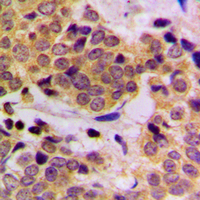 19 - Anti-SHPTP2 (Phospho-Y542) Antibody AP60046