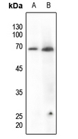 1 - Anti-Paxillin (Phospho-Y118) Antibody AP60047