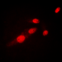3 - Anti-NF-kappaB p65 (Acetyl-K310) Antibody AP60048