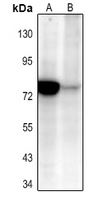 1 - Anti-NF-kappaB p65 (Acetyl-K310) Antibody AP60048