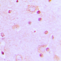 19 - Anti-SRSF7 Antibody AP60049