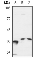 1 - Anti-SRSF7 Antibody AP60049