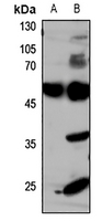 1 - Anti-GLUT4 Antibody AP60050